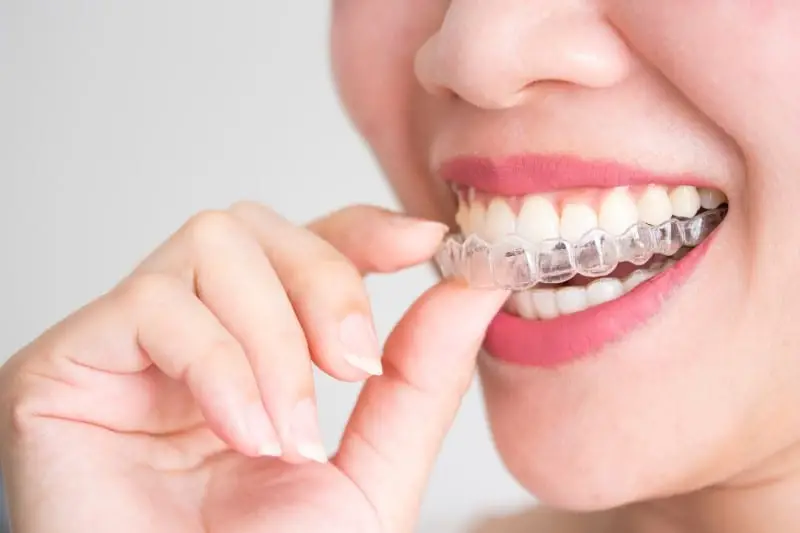 A smiling woman holding invisalign or invisible braces, orthodontic equipment @ practice tepper
